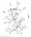 Fig. 02 - Surgical Table with Moveable Perineal Post