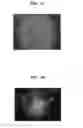 Fig. 03 - Clinical grade sodium alginate for microencapsulation of myofibroblasts isolated from wharton jelly for prevention and treatment of autoimmune and inflammatory diseases
