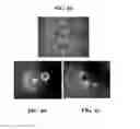 Fig. 04 - Clinical grade sodium alginate for microencapsulation of myofibroblasts isolated from wharton jelly for prevention and treatment of autoimmune and inflammatory diseases