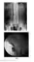 Fig. 02 - Enterically coated cysteamine, cystamine and derivatives thereof