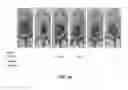 Fig. 02 - Composition comprising GPCR19 agonist as an active ingredient for preventing or treating allergic dermatitis