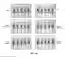 Fig. 03 - Composition comprising GPCR19 agonist as an active ingredient for preventing or treating allergic dermatitis