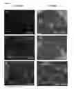 Fig. 08 - Differentiation of human embryonic stem cells