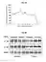 Fig. 05 - Methods of treating muscular dystrophy