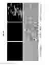 Fig. 21 - Methods of treating muscular dystrophy