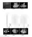 Fig. 28 - LIGHT-SENSITIVE ION CHANNELS FOR INDUCTION OF CARDIAC ACTIVITY