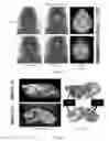 Fig. 07 - Materials and methods useful for treating glioblastorna