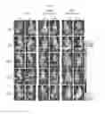 Fig. 09 - Targeting-enhanced anticancer nanoparticles and preparation methods of same