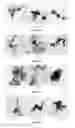 Fig. 27 - NOVEL COMPOUND WITH EFFECTS OF THROMBOLYSIS, FREE RADICAL SCAVENGING AND THROMBUS-TARGETING AS WELL AS PREPARATION METHOD AND USE THEREOF