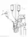 Fig. 01 - Sensors for catheter pumps