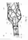 Fig. 32 - Sensors for catheter pumps
