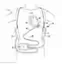 Fig. 01 - Ventricular assist devices