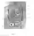 Fig. 02 - Methods for LVAD operation during communication losses