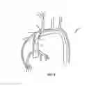 Fig. 09 - CATHETER FOR VASCULAR IMAGING, METHOD OF IMAGING, AND METHOD FOR INTERVENTIONAL PROCEDURE USING THE CATHETER