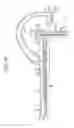 Fig. 16 - Insufflation system and insufflation apparatus