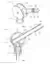 Fig. 02 - Aseptic connector