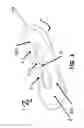 Fig. 02 - Device to treat incontinence