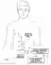 Fig. 02 - Protective patch for protecting the implant site of a trial neurostimulation lead