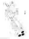 Fig. 06 - Method and apparatus for applying a uniform texture to a substantially vertical surface