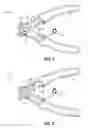 Fig. 02 - Expanding Grips