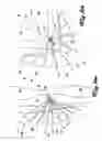 Fig. 07 - Pneumatic exomuscle system and method