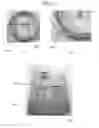 Fig. 07 - INJECTION MOLDING METHOD AND INJECTION MOLDED ARTICLE