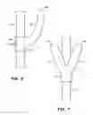 Fig. 06 - Paddle assembly