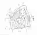 Fig. 02 - Self-righting frame and aeronautical vehicle