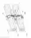 Fig. 05 - Bundle spacing device