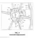 Fig. 08 - Zero turn radius reel