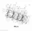 Fig. 09 - Apparatus for automatically equalizing tensions in elevator wire ropes