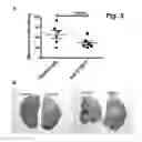 Fig. 06 - Methods and products for preventing and/or treating metastatic cancer