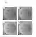 Fig. 07 - SEALANT COMPOSITION FOR ELECTRICAL AND ELECTRONIC PARTS, COATING AGENT FOR ELECTRICAL AND ELECTRONIC PARTS, AND LED DEVICE
