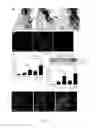 Fig. 02 - Sortilin 1 is a novel inducer of vascular calcification