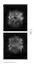 Fig. 04 - Spatial sequencing of nucleic acids using DNA origami probes