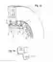 Fig. 02 - Axle-mounted brake disc with a connecting element