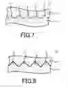 Fig. 06 - BRAKE PAD AND CALIPER DEVICE