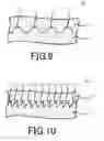 Fig. 07 - BRAKE PAD AND CALIPER DEVICE