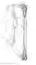 Fig. 01 - COMPOUND BOW STRUCTURE