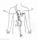 Fig. 01 - Quick conversion sling