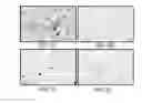 Fig. 04 - Method for the quantification of parasite eggs in feces