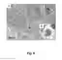 Fig. 07 - Tumor cell-derived microvesicles