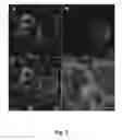 Fig. 08 - Tumor cell-derived microvesicles