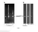 Fig. 03 - Methods of renal cancer detection