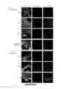 Fig. 07 - METHODS FOR CLASSIFYING TUMORS AND USES THEREFOR