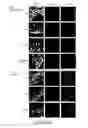 Fig. 09 - METHODS FOR CLASSIFYING TUMORS AND USES THEREFOR