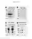 Fig. 17 - Methods and compositions for detecting misfolded proteins