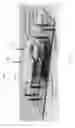 Fig. 09 - Reconfigurable diffractive optical switch