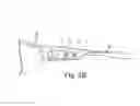 Fig. 04 - Temple Vent Lock Clip