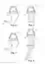 Fig. 06 - Temple Vent Lock Clip
